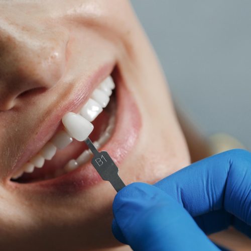 Cómo Atraer Pacientes de Implantes Dentales con Google Ads y SEM